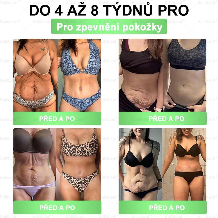 ✅𝑩𝒖𝒊𝒍𝒅𝑳𝒆𝒂𝒇® 𝑮𝑳𝑷-1 8-𝒊𝒏-1 𝑺𝒍𝒊𝒎 & 𝑯𝒆𝒂𝒍𝒕𝒉𝒚 Ú𝒔𝒕𝒏í 𝒓𝒐𝒛𝒕𝒐𝒌(Jednou denně, viditelné výsledky za 7 dní). Podporuje boj s obezitou, zdraví kardiovaskulárního systému, diabetes, zdraví střev